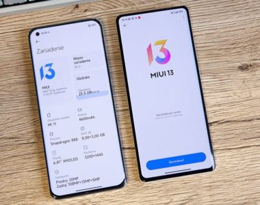 В обновлении MIUI на Xiaomi нет трех точек - что делать?