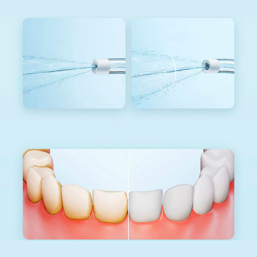 irrigator-xiaomi-mijia-electric-teeth-flosser-f300-4.jpg